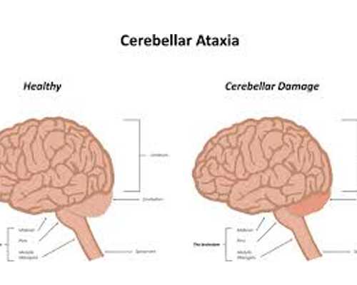 代怀价格与试管生男孩费用解析