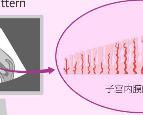 北京家圆与北医三院辅助生殖技术对比及代生选择指南