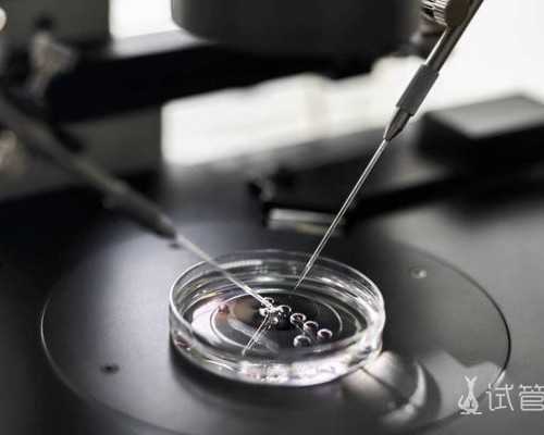 试管婴儿取卵费用及流程详解，助孕选择指南