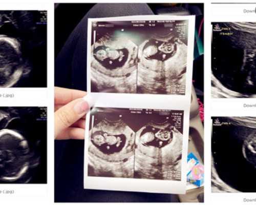 人类精子库捐精现状与辅助生殖技术监管分析