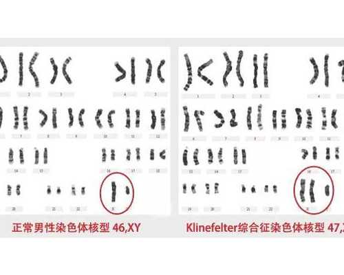 北京三代试管助孕费用解析及北京大学人民医院试管婴儿服务评价