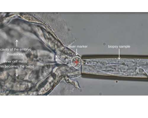 供卵试管流程解析与医院选择指南